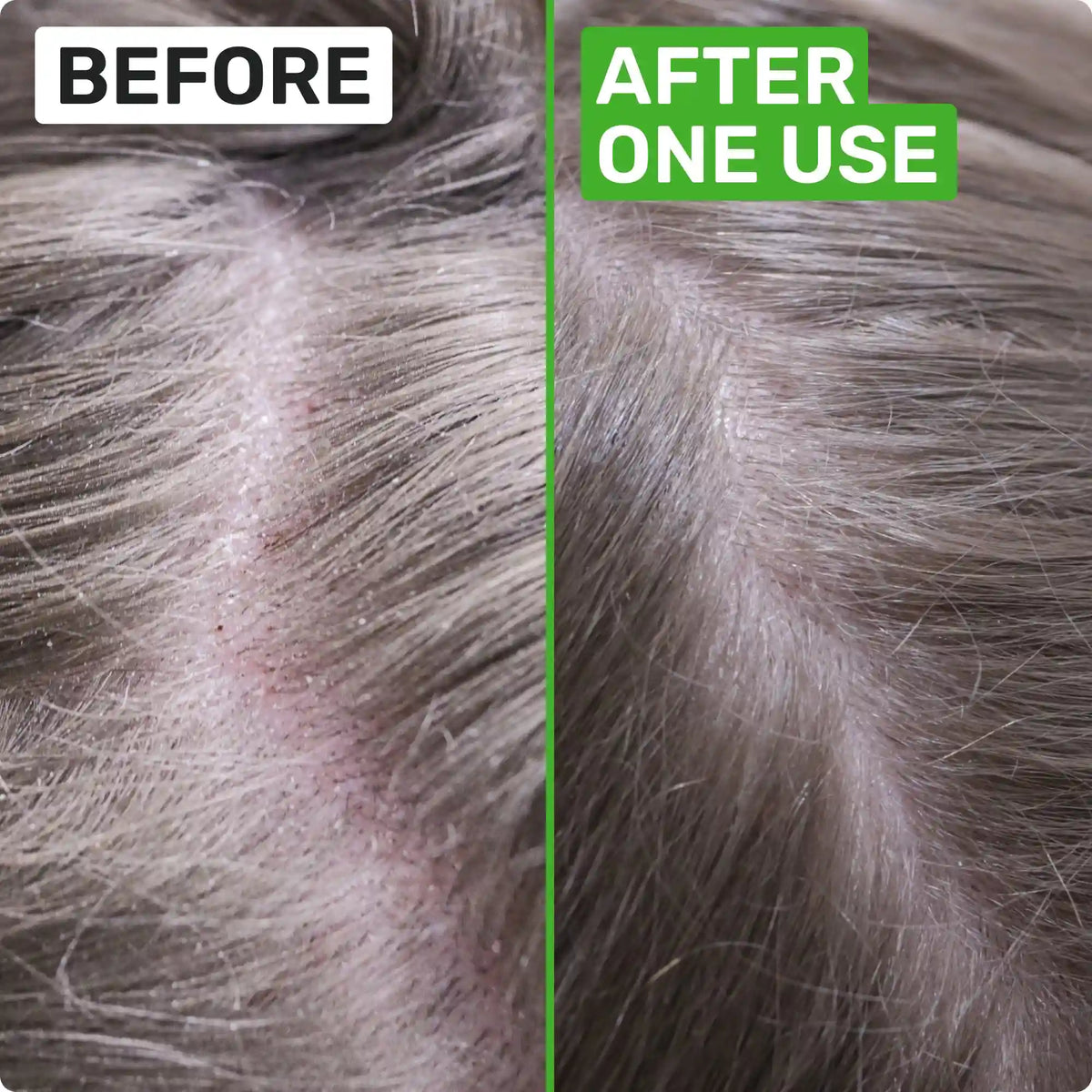 SCALP HEALTH Shampoo Bar